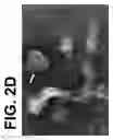 Fig. 06 - PHARMACEUTICAL COMPOSITION FOR TREATMENT OF ATOPY CONTAINING EXOSOMES DERIVED FROM NEURAL STEM CELLS
