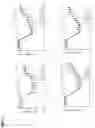 Fig. 14 - Methods and compositions for treating gastrointestinal and inflammatory disorders