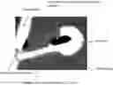 Fig. 01 - Parvovirus formulation for treating tumors