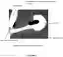 Fig. 02 - Parvovirus formulation for treating tumors
