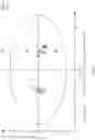 Fig. 40 - Treating dry eye disorders