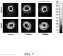 Fig. 04 - Compositions and methods for the treatment of orthopedic ailments