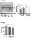 Fig. 19 - Methods for treating depression and major depressive disorder