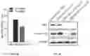 Fig. 09 - Gene therapy strategy to restore electrical and cardiac function, and cardiac structure, in arrhythmogenic right ventricular cardiomyopathy