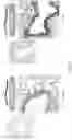 Fig. 04 - Composition and methods for treatment of primary ciliary dyskinesia