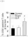 Fig. 02 - B7-H1 fusion polypeptides for treating and preventing organ failure