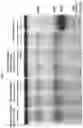 Fig. 02 - Lentiviral vector for treating hemoglobin disorders