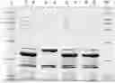 Fig. 01 - Proteins and immunizing compositions containing pasteurella proteins and methods of use