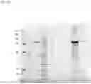 Fig. 41 - Proteins and immunizing compositions containing pasteurella proteins and methods of use
