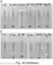 Fig. 33 - Glycosylated analogues of Flavivirus E proteins and their use in diagnostic methods