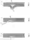 Fig. 02 - Devices and methods and agent-assisted medical procedures