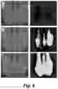 Fig. 07 - Osteoadsorptive fluorogenic substrate of cathepsin k for imaging osteoclast activity and migration