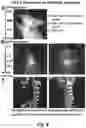 Fig. 08 - Osteoadsorptive fluorogenic substrate of cathepsin k for imaging osteoclast activity and migration