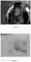 Fig. 05 - Kits, compositions and methods for wound treatment and management