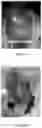 Fig. 07 - Kits, compositions and methods for wound treatment and management