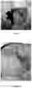 Fig. 09 - Kits, compositions and methods for wound treatment and management