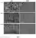 Fig. 05 - BIOARTIFICIAL MEMBRANES HAVING CONTROLLED VISCOELASTICITY AND RIGIDITY FOR USE IN TISSUE ENGINEERING