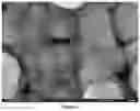 Fig. 04 - METHOD FOR ENDOTHELIALIZING VASCULAR PROSTHESES