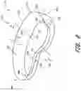 Fig. 18 - Irrigation fluid containment systems