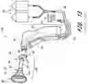 Fig. 22 - Irrigation fluid containment systems