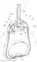 Fig. 01 - Enema device and a method of refilling said device with an enema