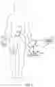 Fig. 02 - SKELETAL MUSCLE STIMULATION FOR GLUCOSE CONTROL