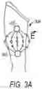 Fig. 05 - SKELETAL MUSCLE STIMULATION FOR GLUCOSE CONTROL
