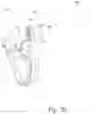Fig. 17 - Electrically stimulated respiratory assistance components
