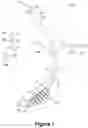 Fig. 02 - TRACHEAL TUBE AND SUCTION DEVICE