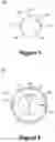 Fig. 05 - TRACHEAL TUBE AND SUCTION DEVICE