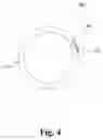 Fig. 05 - Expandable Endotracheal Tube