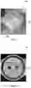 Fig. 04 - Method and device for administering a humidified aerosol to a patient interface
