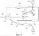 Fig. 13 - Rapid aspiration thrombectomy system and method