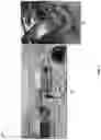 Fig. 05 - Electrospray catheter