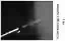 Fig. 06 - Electrospray catheter