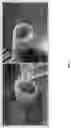 Fig. 08 - Electrospray catheter