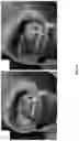Fig. 13 - Electrospray catheter