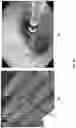 Fig. 40 - Electrospray catheter