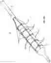 Fig. 03 - Device and method for compartmental vessel treatment