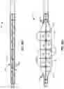 Fig. 04 - Device and method for compartmental vessel treatment