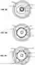 Fig. 06 - Device and method for compartmental vessel treatment