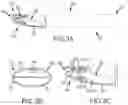 Fig. 04 - Delivery systems and method thereof