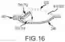 Fig. 19 - Delivery systems and method thereof