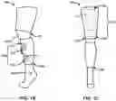 Fig. 03 - Device and system for real-time gait modulation and methods of operation thereof