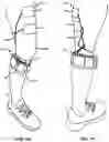 Fig. 06 - Device and system for real-time gait modulation and methods of operation thereof