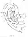 Fig. 02 - Auricular nerve stimulation to address patient disorders, and associated systems and methods