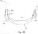 Fig. 09 - Auricular nerve stimulation to address patient disorders, and associated systems and methods