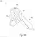 Fig. 10 - Auricular nerve stimulation to address patient disorders, and associated systems and methods