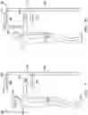 Fig. 02 - Stereognosis training system and method for patients with chronic stroke, spinal cord injury or neuropathy