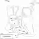 Fig. 01 - Terminating pacemaker mediated tachycardia (PMT) in dual chamber leadless pacemaker systems